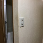 【Before】ヤニ③